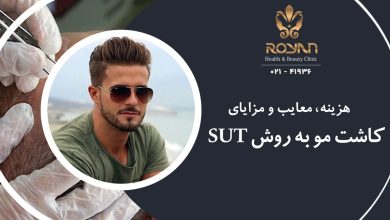 کاشت مو به روش SUT