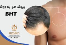 کاشت موی BHT