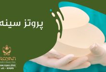 پروتز سینه