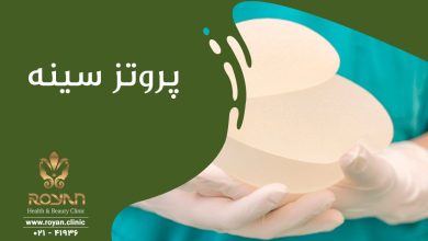 پروتز سینه