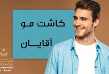 کاشت موی سر مردان
