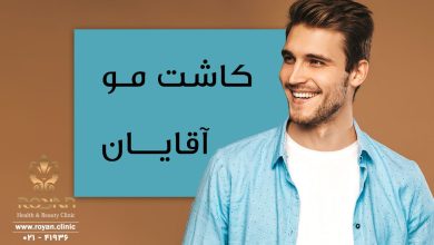 کاشت موی سر مردان