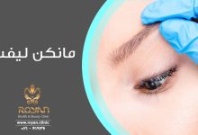 مانکن لیفت چیست ؟