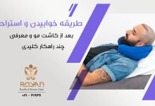 خوابیدن بعد از کاشت مو