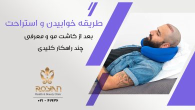 خوابیدن بعد از کاشت مو