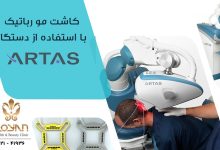 کاشت مو با دستگاه آرتاس