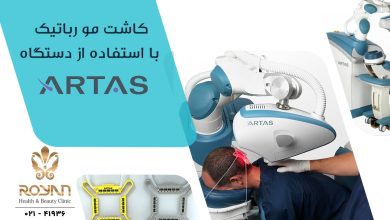 کاشت مو با دستگاه آرتاس