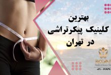 بهترین کلینیک پیکرتراشی در تهران
