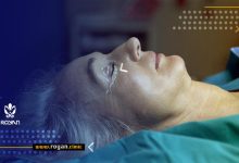 درد بعد از جراحی پلک