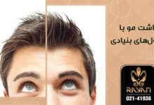 کاشت مو سلول های بنیادی