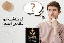 دائمی بودن کاشت مو