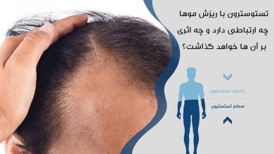 تستوسترون و ریزش مو