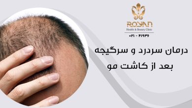 سردرد بعد از کاشت مو