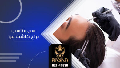 سن مناسب کاشت مو