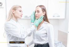 بهترین مرکز جراحی پلک