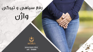 رفع تیرگی واژن