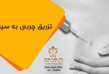 تزریق چربی به سینه