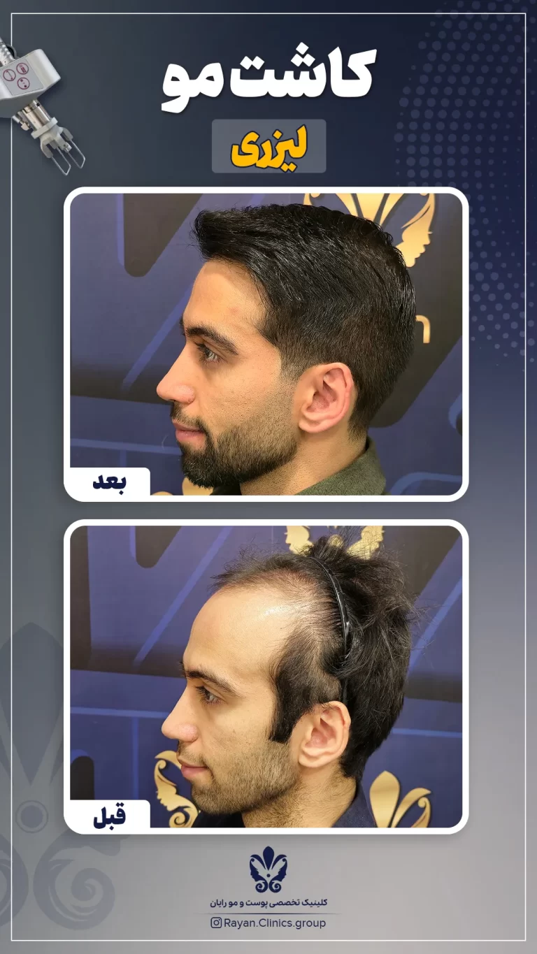 2.3