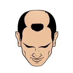 گرید 5